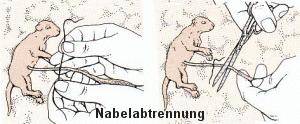 Nabelabtrennung